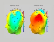 The Symposium covered topics such as comparing baseline brain activity with cognitive activity Image comparing baseline brain activity with cognitive activity