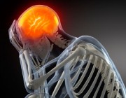 A picture of a skeleton with a glowing brain, indicating head pain.