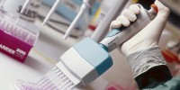 A photograph of a hand using a multi-channel pipette.